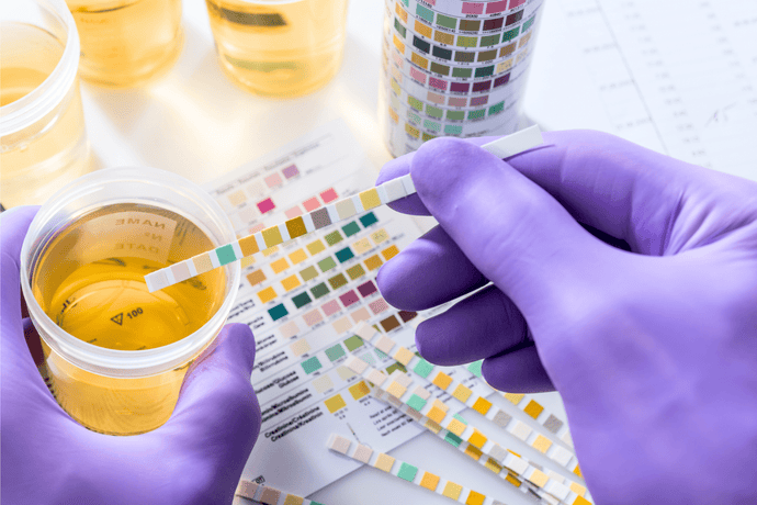How Much Urine Do You Need for a Drug Test? FAQs and Best Practices